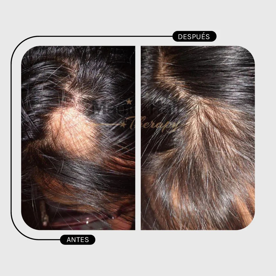 Magic Hair Loss Hair Pilostrong & Calendula Kit