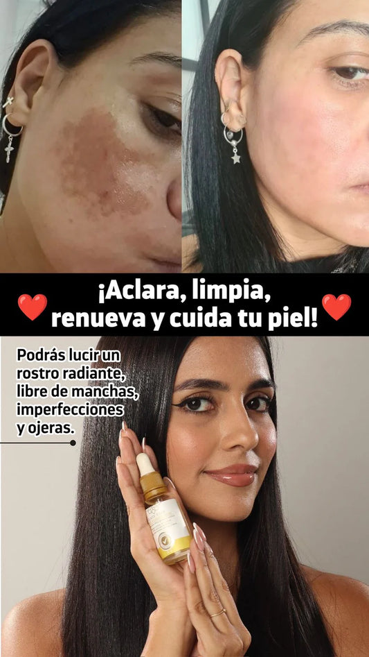Class Gold Depigmenting Facial Tonic