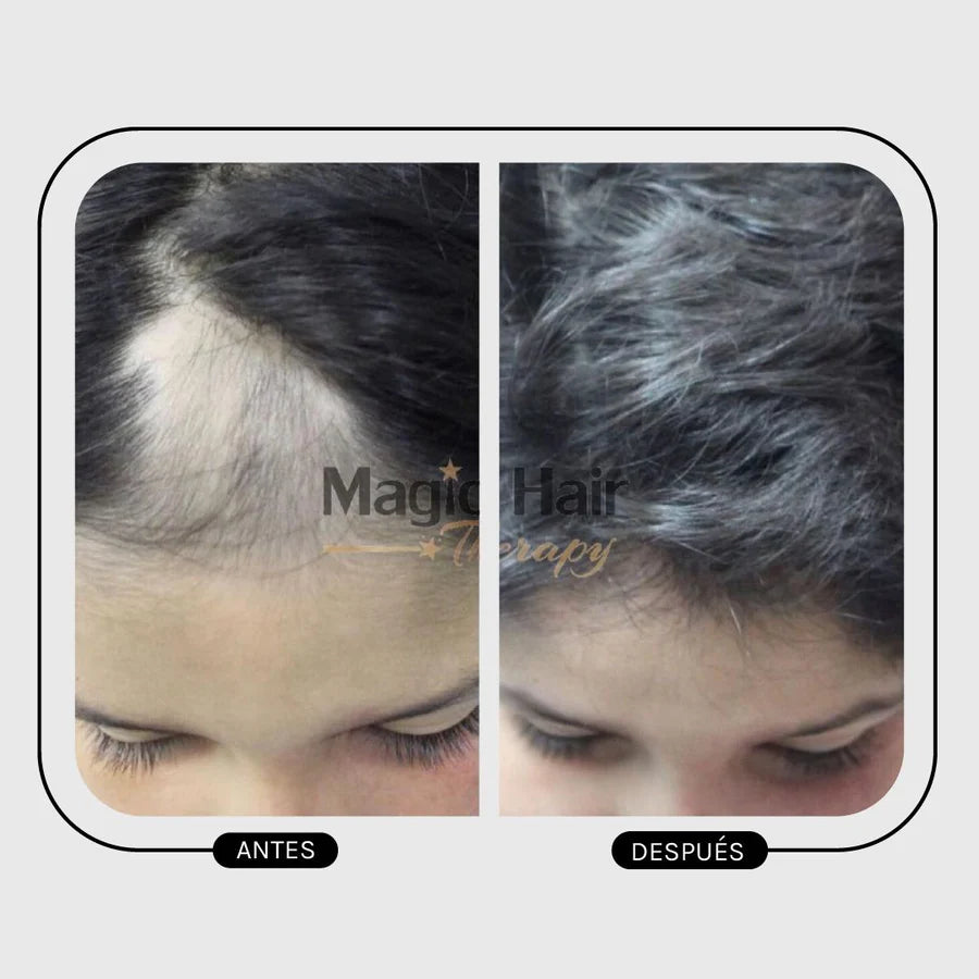 Magic Hair Loss Hair Pilostrong Duo