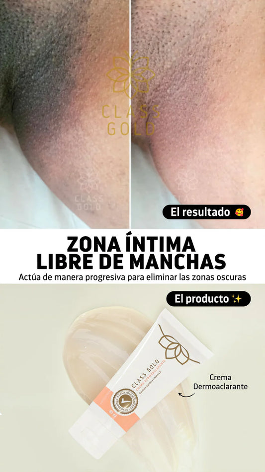 Class Gold Body Lightening Dermo Cream