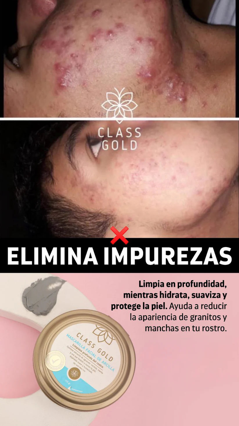 Mascarilla facial de arcilla dorada de clase