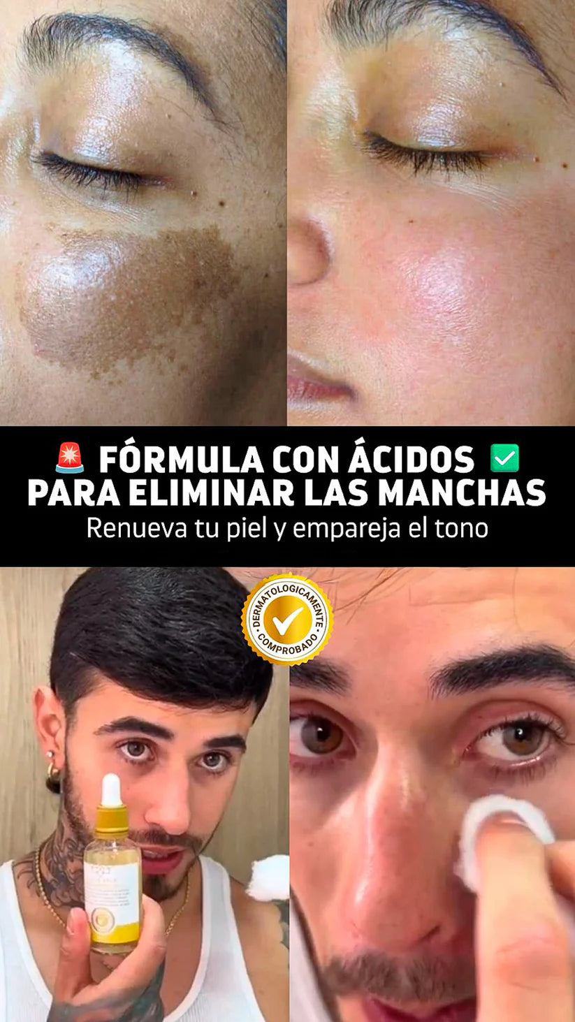 Class Gold Depigmenting Facial Tonic