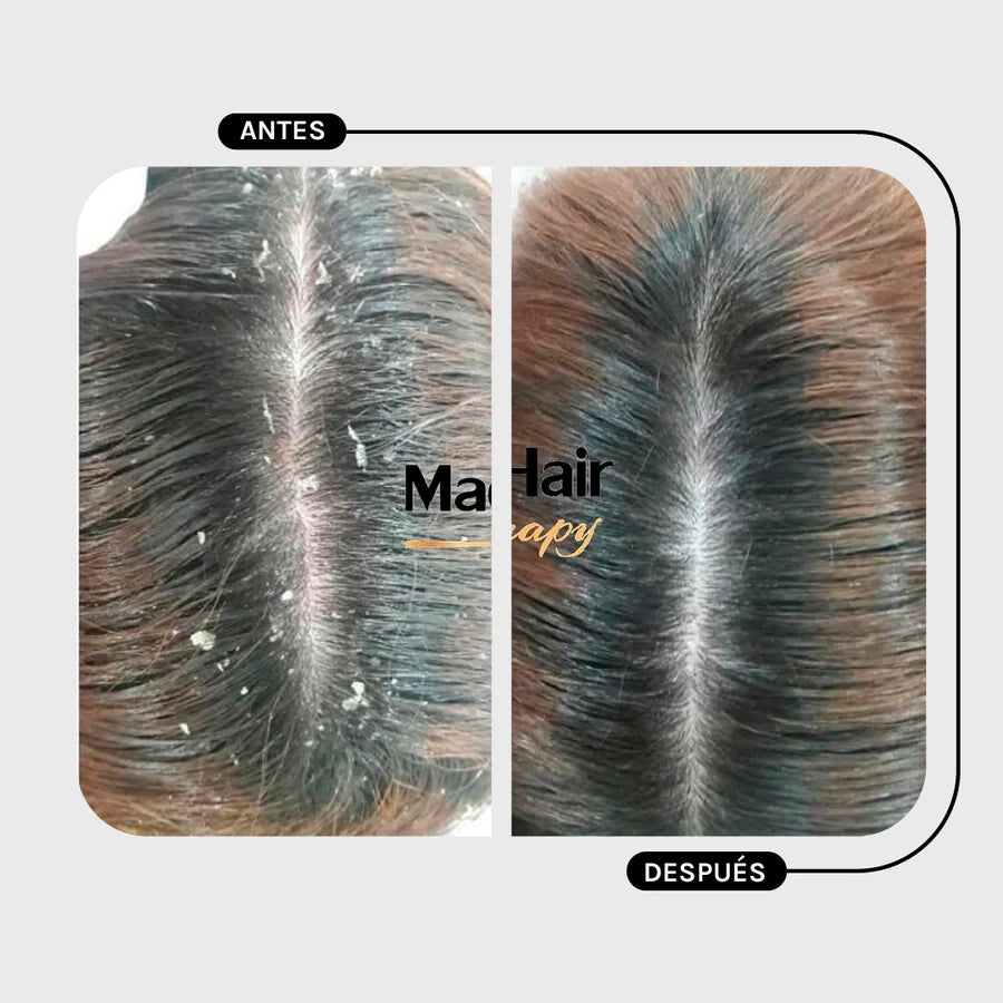 Magic Hair Anti-Dandruff Conditioner