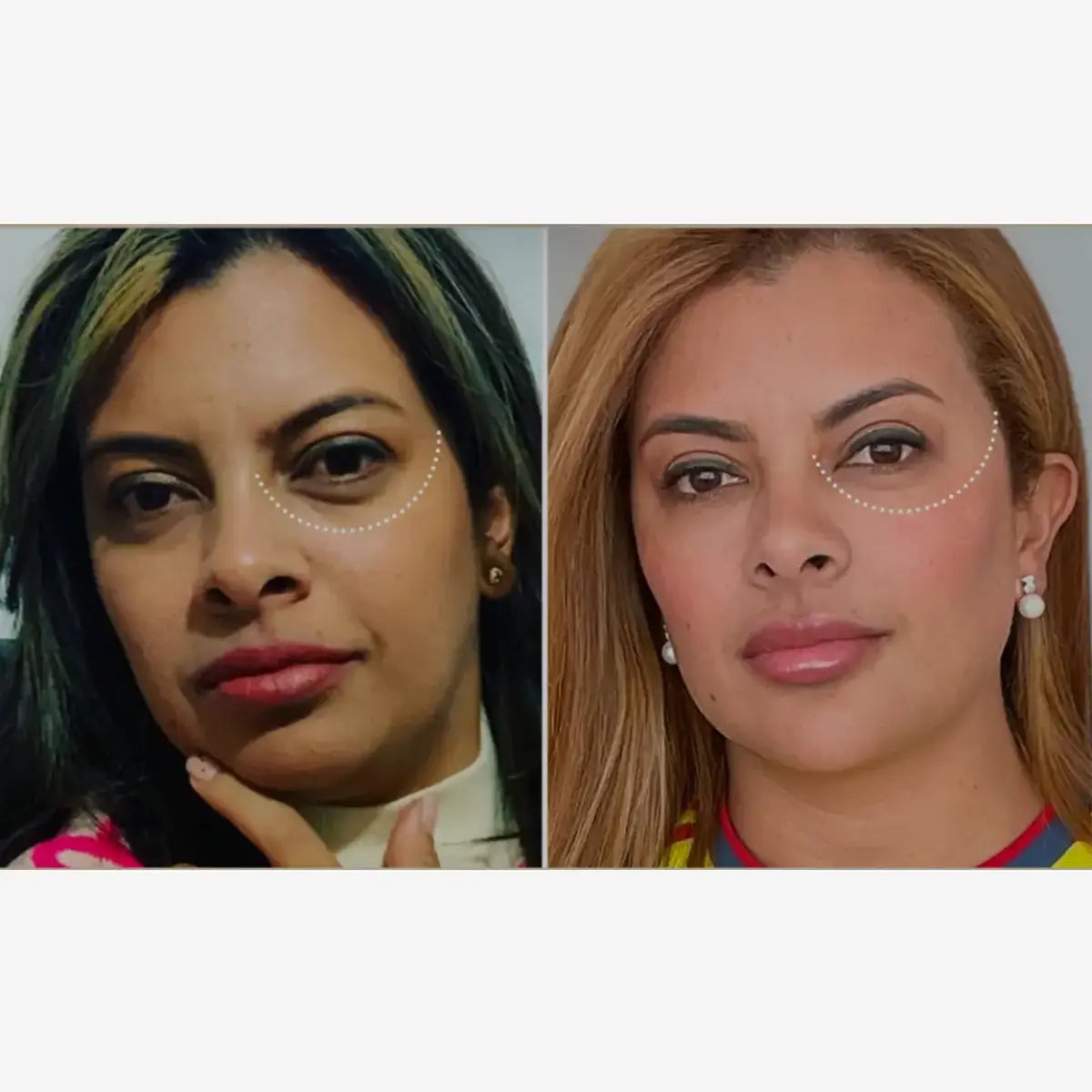 Camila Barrientos Eye Contour