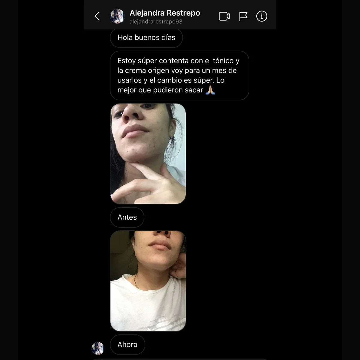 Camila Barrientos Depigmenting Tonic