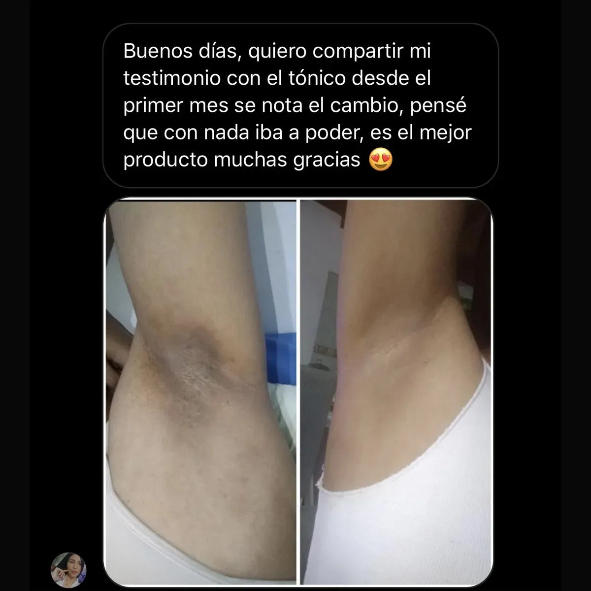 Camila Barrientos Depigmenting Tonic
