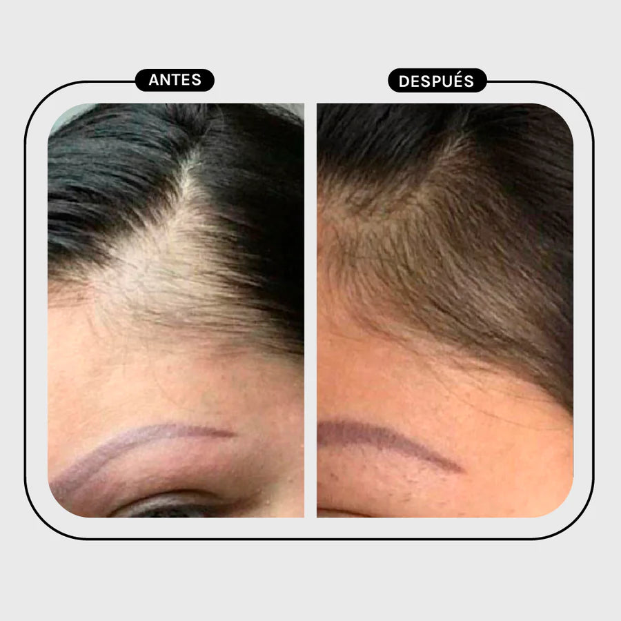 Magic Hair Conditioner Therapy Hair Loss - Dry Hair