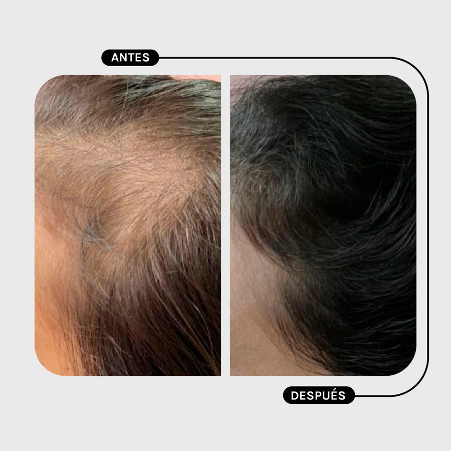 Magic Hair Shampoo Amino+