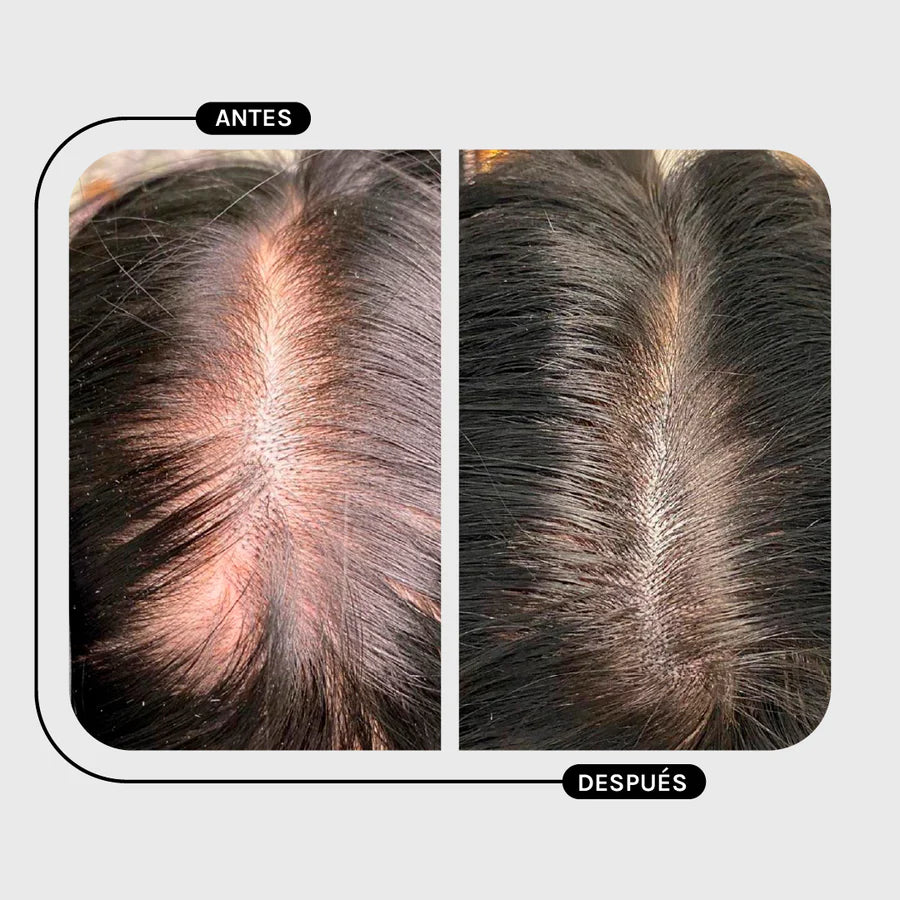 Magic Hair Treatment Calendula