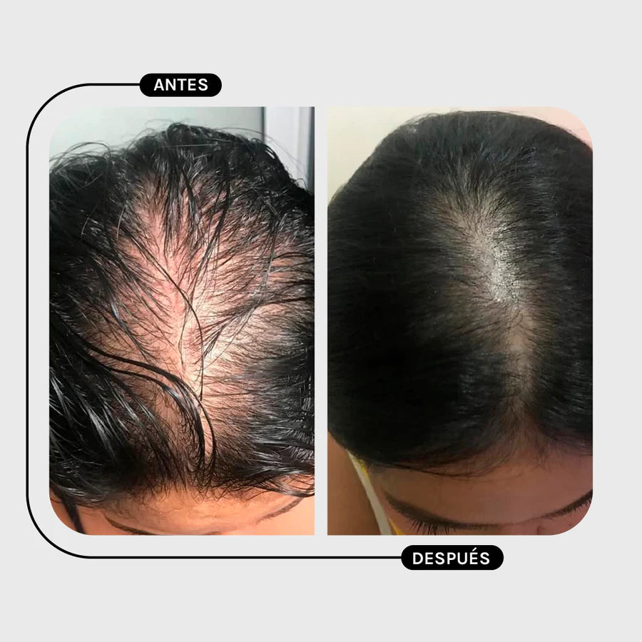 Magic Hair Shampoo Pilostrong & Calendula