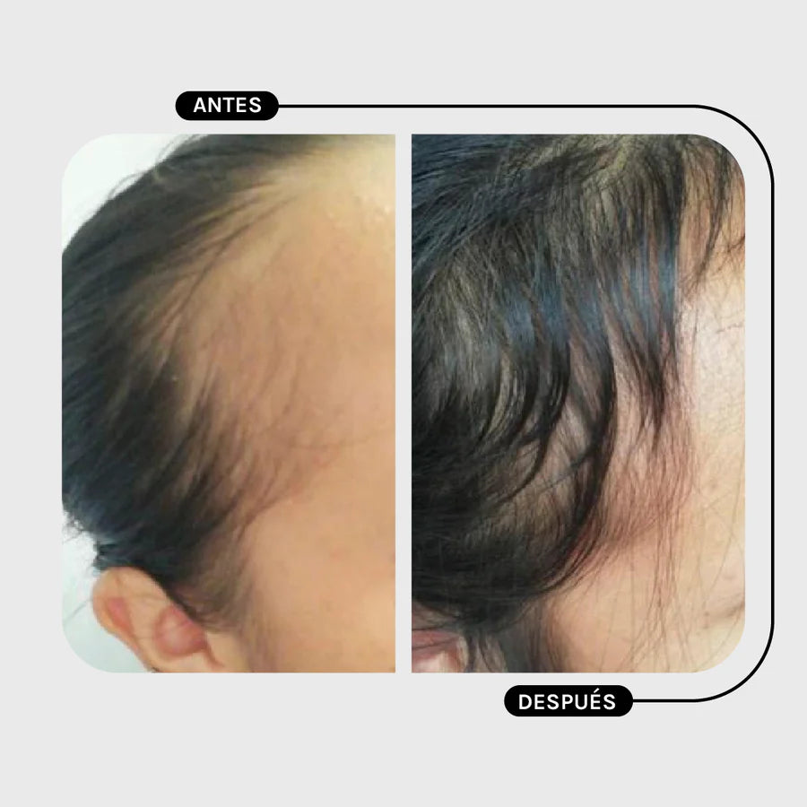 Magic Hair Conditioner Pilostrong