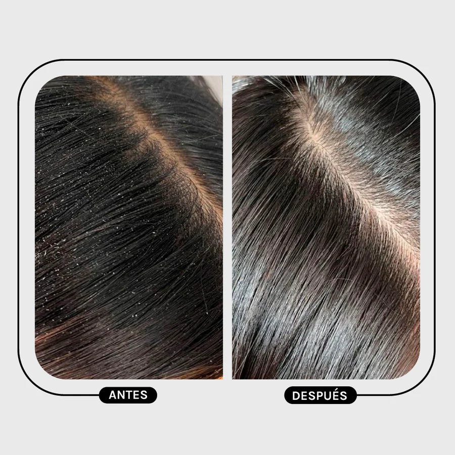 Magic Hair Anti-Dandruff Duo