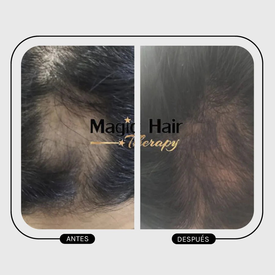 Magic Hair Amino Duo - Strengthen & Prevent Hair Loss