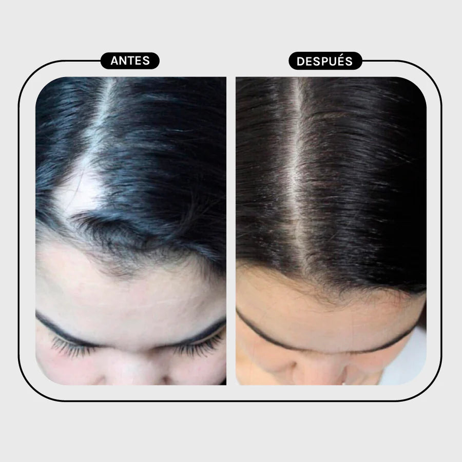 Magic Hair Treatment Nocturno - Hair Loss, Growth & Repair